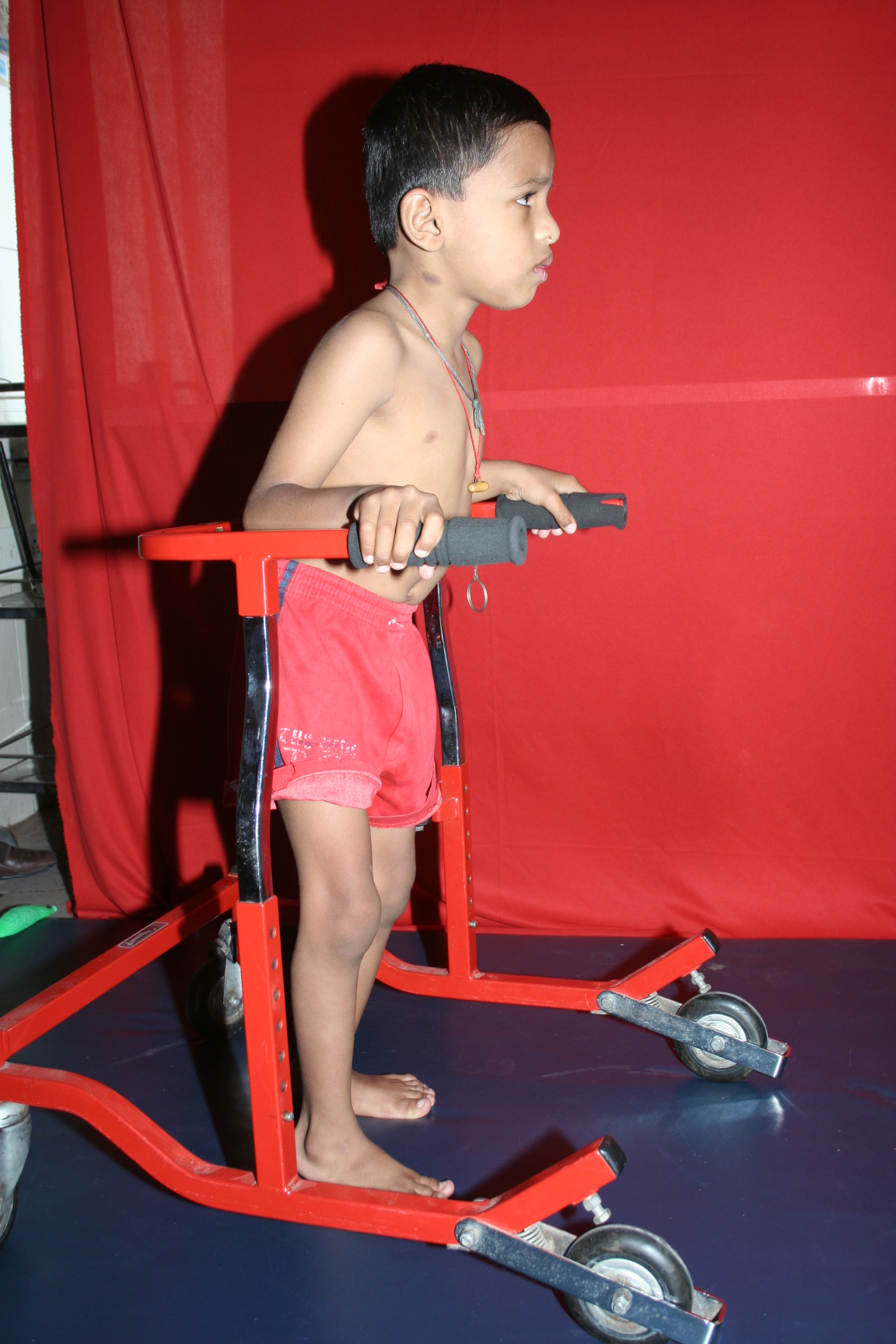 Adaptive Equipment for Children with Cerebral Palsy